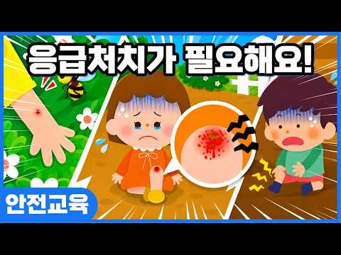 무릎이 까졌을 땐 어떻게 해야할까요? 상황별 응급처치 방법!ㅣ안전교육ㅣ키드키즈